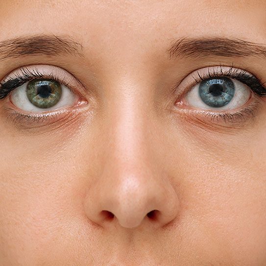 - Levin Eye Care Center